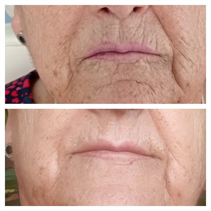 antes y despues 3