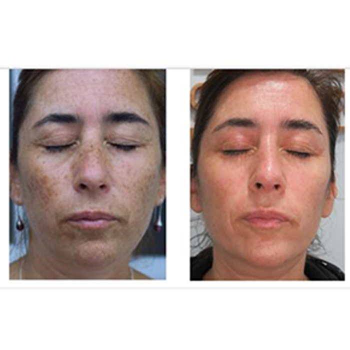 antes y despues 4