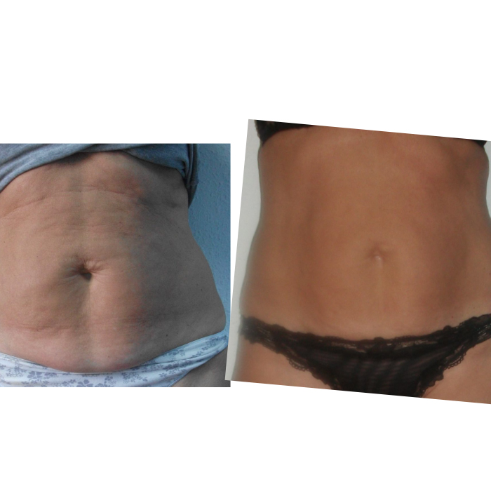 antes y despues 5