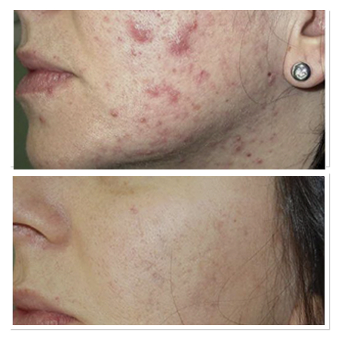 antes y despues 6