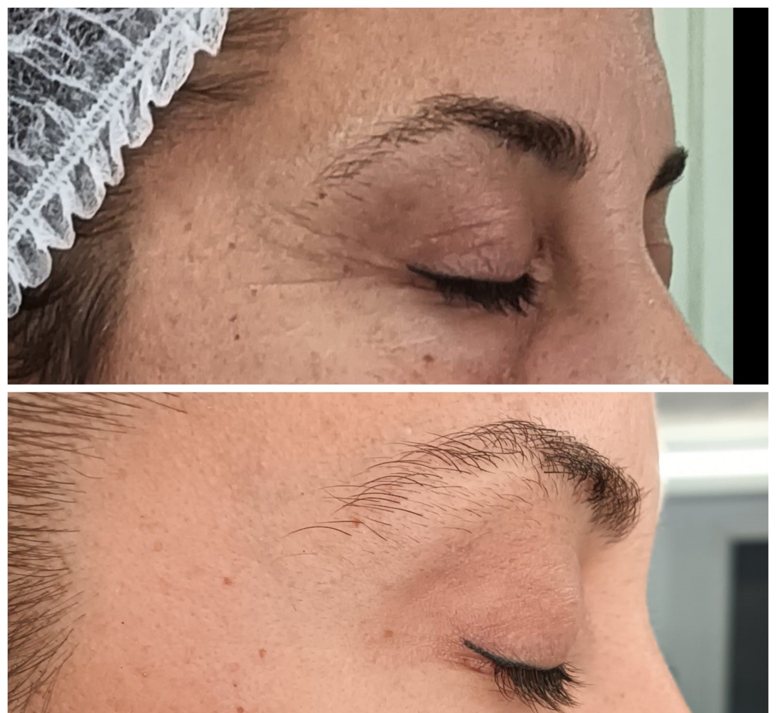 antes y despues co2 1